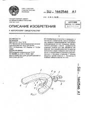 Устройство для душирования и массажа десен (патент 1662546)