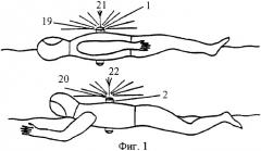 Система для обнаружения человека, терпящего бедствие на воде (патент 2363614)