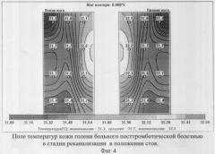 Способ комбинированной термометрии для диагностики посттромботической болезни вен нижних конечностей (патент 2319438)