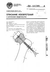 Устройство для остеосинтеза (патент 1217391)