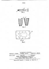 Устройство осадченко в.с. для заделки пробоин с рваными краями в стенке емкости (патент 963895)