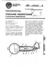 Устройство для измерения параметров зуба (патент 1101227)