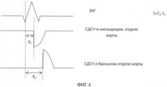 Способ выявления повышенной жесткости аорты у пациентов с кардиопатологиями (патент 2511059)