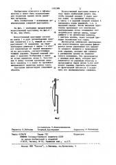 Искусственный хрусталик глаза конструкции пучковской- голубенко (патент 1165389)