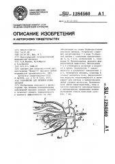 Устройство для лечения полых органов (патент 1284560)