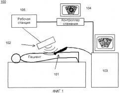 Система и способ для объединения ультразвуковых изображений в реальном времени с ранее полученными медицинскими изображениями (патент 2468436)