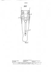 Протез голени (патент 1465046)