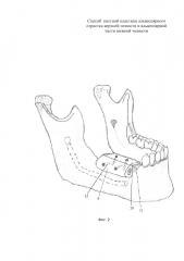Способ костной пластики альвеолярного отростка верхней челюсти и альвеолярной части нижней челюсти (патент 2661039)