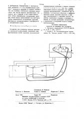 Устройство для измерения перепададавления co статической компенсацией (патент 815536)