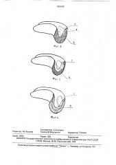Устройство для лечения заболеваний полости рта и зубов (патент 1669445)