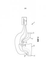 Компенсация тепловых напряжений в вибрационном расходомере с изогнутым трубопроводом (патент 2581436)