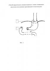Способ хирургического лечения вторичного стеноза пищеводного анастомоза после резекции проксимального отдела желудка (патент 2657192)