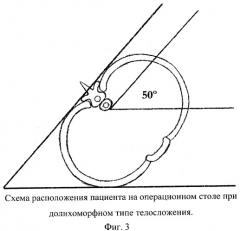 Способ лечения заболеваний пищевода (патент 2269941)