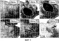 Сенсибилизированный оперативный bold-mri способ получения изображения (патент 2343829)