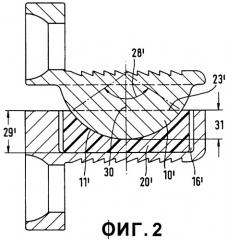 Межпозвонковые протезы шейного отдела позвоночника (патент 2381771)