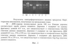 Способ определения предрасположенности человека к развитию агрессивных неходжкинских лимфом (патент 2373862)