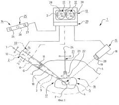Устройство для неинвазивного ультразвукового лечения болезни диска (патент 2288756)
