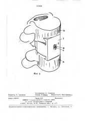 Фиксатор позвоночника (патент 1424826)