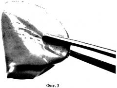 Биодеградируемое раневое покрытие и способ получения биодеградируемого раневого покрытия (патент 2519158)