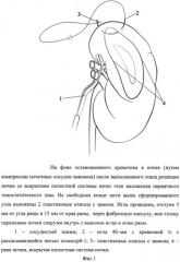 Способ ушивания раны почки при лапароскопическом органосохраняющем лечении рака почки в условиях тепловой ишемии (патент 2532897)