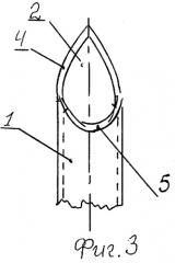 Хирургическое шило (патент 2299025)