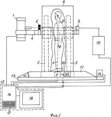 Рентгенографическая установка для медицинской диагностики (патент 2352252)