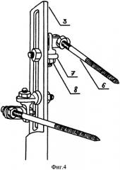 Устройство для внеочагового стержневого остеосинтеза переломов длинных трубчатых костей (патент 2485905)