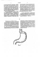 Способ резекции желудка (патент 1796159)