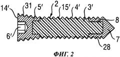 Костный винт (патент 2521537)
