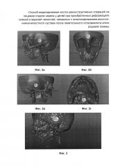 Способ моделирования костно-реконструктивных операций на лицевом отделе черепа у детей при приобретенных деформациях нижней и верхней челюстей, связанных с анкилозированием височно-нижнечелюстного сустава после гематогенного остеомиелита и/или родовой травмы (патент 2604774)