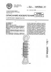Интрамедуллярный фиксатор для лечения переломов трубчатых костей (патент 1692566)
