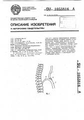 Способ оперативного лечения воронкообразной грудной клетки (патент 1053816)