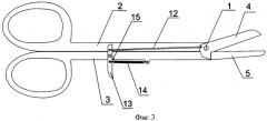 Хирургические ножницы для бескровного рассечения тканей (варианты) (патент 2351291)