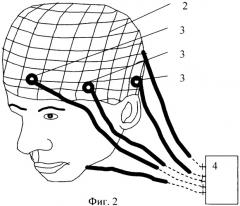 Способ мохова-чащина получения данных о состоянии краниальных тканей и устройство для его осуществления (патент 2396899)
