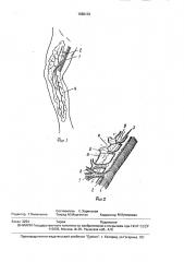 Способ лечения лимфостаза (патент 1680133)