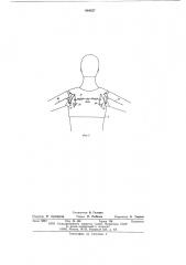Протез плеча с биоэлектрическим управлением (патент 604557)