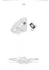 Герметизирующий узел опоры шарошки (патент 560054)