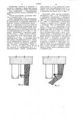 Способ ампутации голени (патент 1149953)