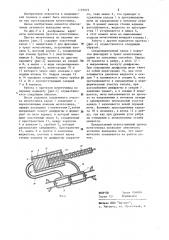 Протез мочеточника (патент 1191075)