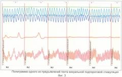 Способ диагностики расстройств сексуальных предпочтений (патент 2406441)