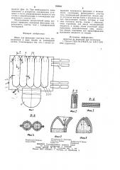 Шина для фиксации участков тела (патент 936903)