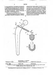 Эндопротез бедренной кости (патент 1653763)