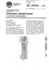 Устройство рубленика и.м. для удлинения костей (патент 1454431)