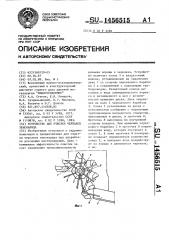 Устройство для очистки черпаков земснаряда (патент 1456515)