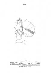 Устройство для лечения переломов костей лицевого черепа (патент 940756)