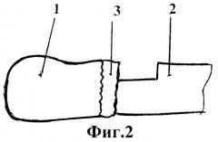 Способ артродезирования 2-3-4-5 запястно-пястных суставов кисти (патент 2421171)