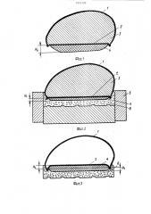 Способ изготовления обуви литьевого метода крепления с профилированным следом, соответствующим анатомическому строению стопы (патент 1574199)