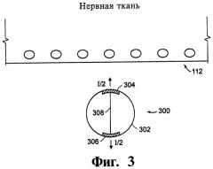 Нейростимулятор и способ стимуляции нервной ткани (патент 2465930)