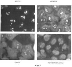 Способ фиксации клеток человека hela и hep-2 для иммуноцитохимического выявления ядерных аутоантигенов (патент 2362583)