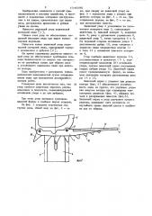 Защитный упор переносной моторной пилы (патент 1046086)